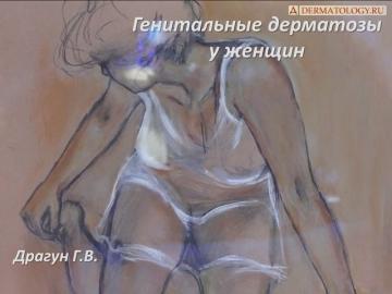 Генитальные дерматозы у женщин. Г.В. Драгун. Москва, 2018